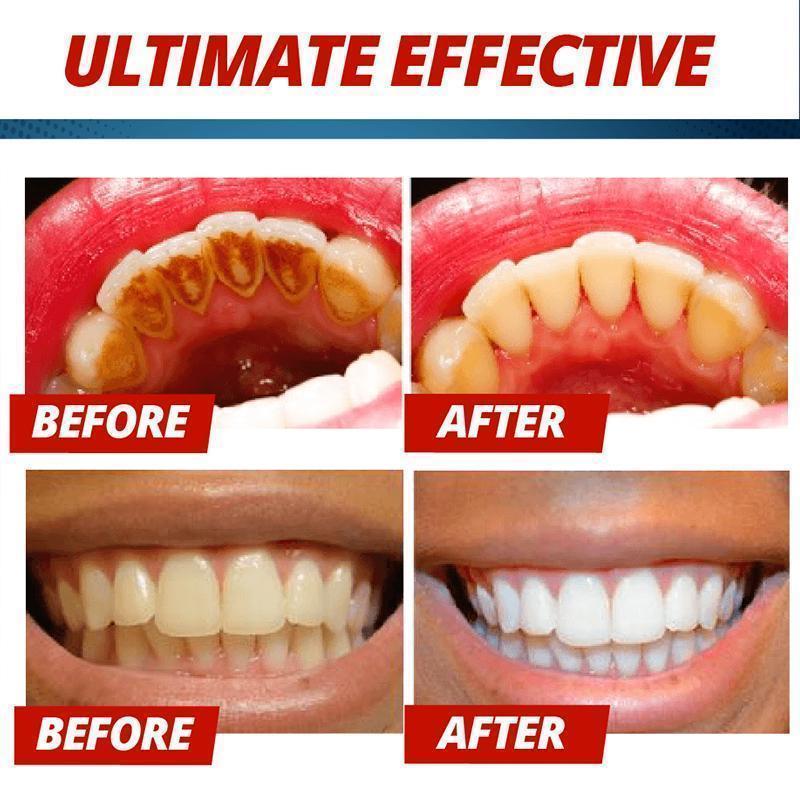 Intensiv Fläckborttagning Whitening Tandkräm