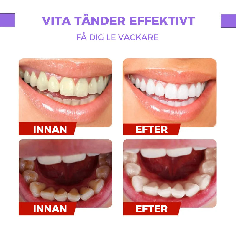 Serum för tandfärgskorrigering